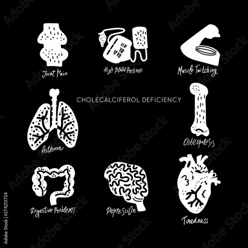 VitaminD Deficiency vector