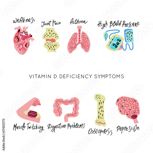 VitaminD Deficiency vector