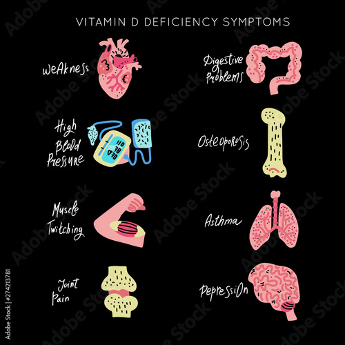 VitaminD Deficiency vector