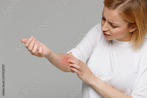 Принти на полотні Close up of young woman scratching the itch on her hand, isolated on grey background