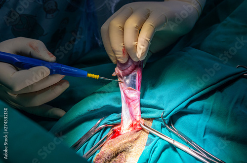 Cutting of a testicular ligament with an electric scalpel photo