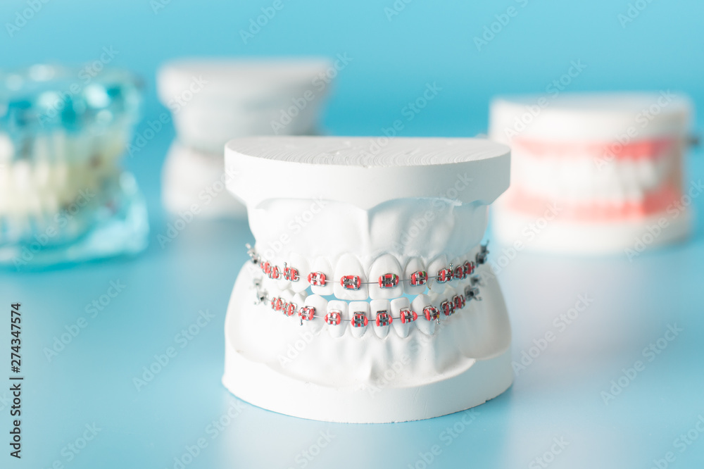 Dental tool with model in dental care concept. Dental tool with model in dental care concept.