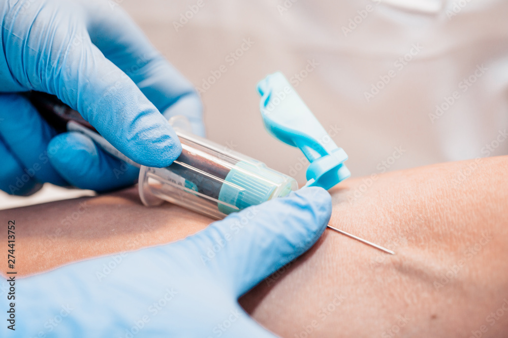 A blood test is a necessary diagnostic tool - it allows you to quickly or as accurately as possible to either refute the diagnosis A blood test is a necessary diagnostic tool - it allows you to quickly or as accurately as possible to either refute the diagnosis