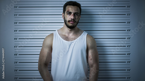 In a Police Station Arrested Beaten Man Poses for Front View Mugshot. He Wears Singlet, is Heavily Bruised. Height Chart in the Background. Shot with Dark Cold Lights and Vignette Filter. photo