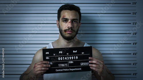 Close-up Shot of an Arrested Beaten Man in a Police Station Poses for Front View Mugshot. He Wears Singlet, is Heavily Bruised and Holds Placard. Height Chart in the Background.