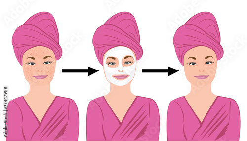 Acne skin disease  before and after treatment