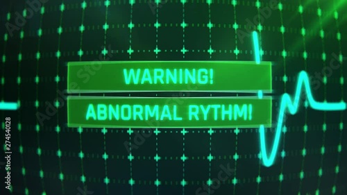 Warning, abnormal rhythm text on cardiogram wave, disease prevention gadgets. Patient's heart rate monitored, healthcare, disease prediction, prevention
