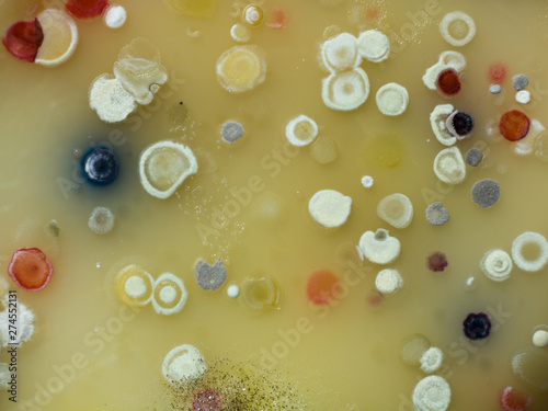 The growth of Actinobacteria cololonies on Cyganow and Žukov's agar plates, with different colony texture and colors. photo