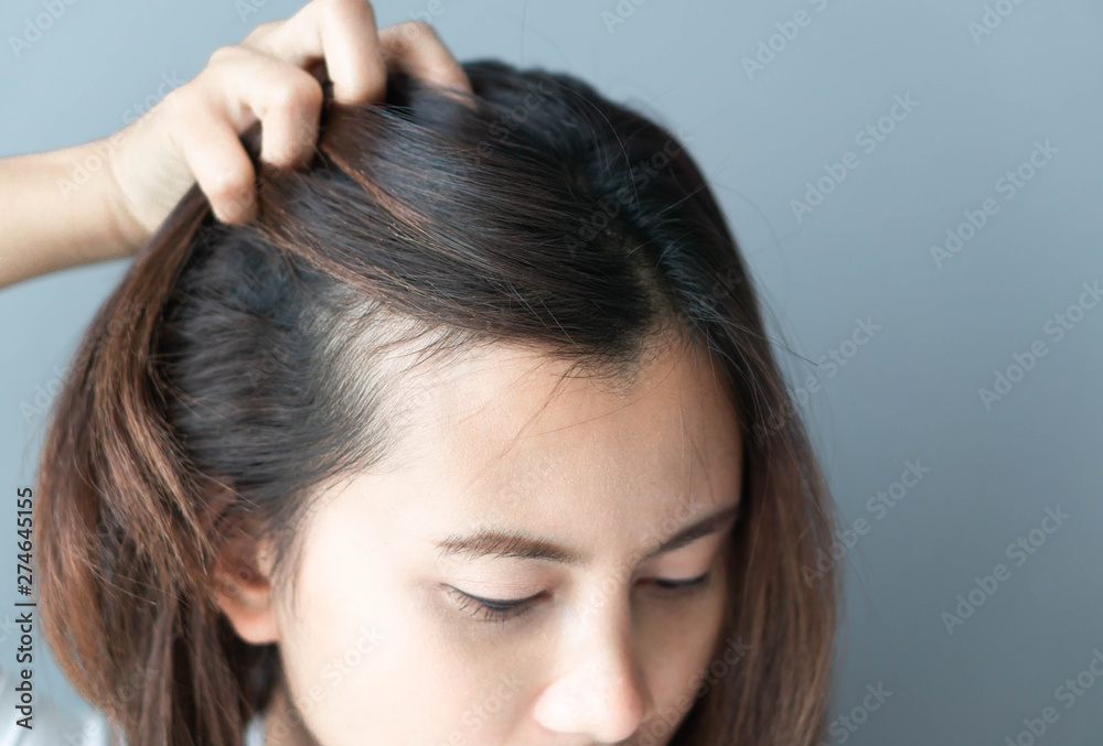 Fototapeta premium Woman looking reflection in the mirror serious hair loss problem for health care shampoo and beauty product concept