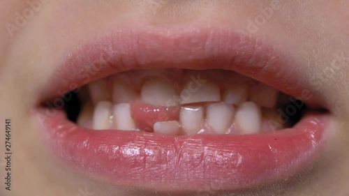 Wallpaper Mural Child Loose Tooth Moving Heavily Back and Forth Torontodigital.ca