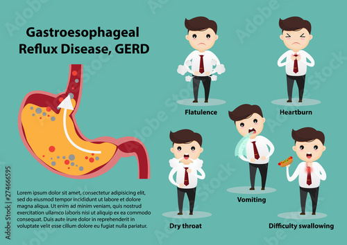 Gastro-Esophageal Reflux Disease (GERD)