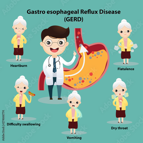 Gastro-Esophageal Reflux Disease (GERD)