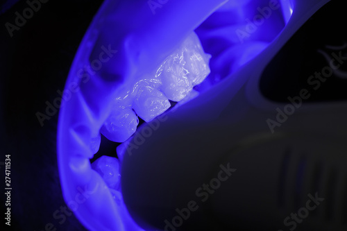 teeth whitening patient with a special gel and ultraviolet