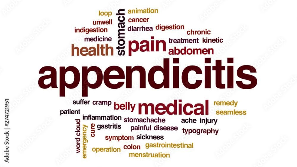 Appendicitis animated word cloud, text design animation. Kinetic typography. Appendicitis animated word cloud, text design animation. Kinetic typography.