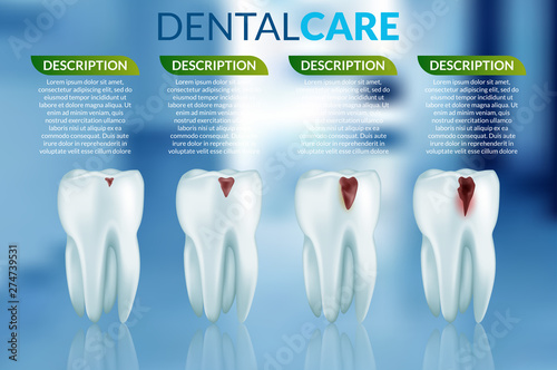 Abstract vector dental illustration of teeth