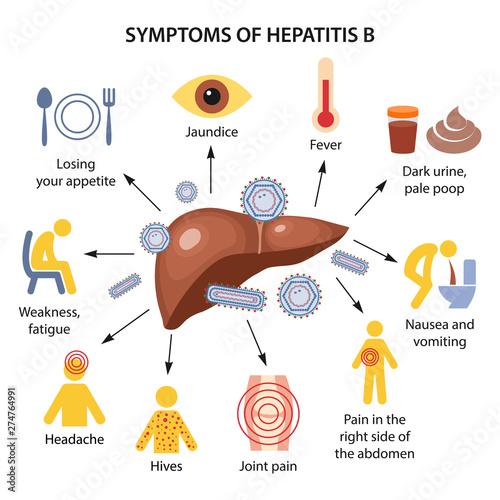 Symptoms of Hepatitis B photo