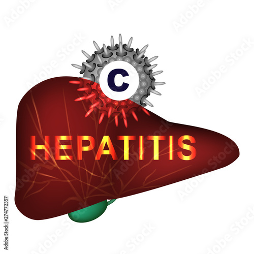 Hepatitis C. World Hepatitis Day. Infographics. Vector illustration on isolated background.