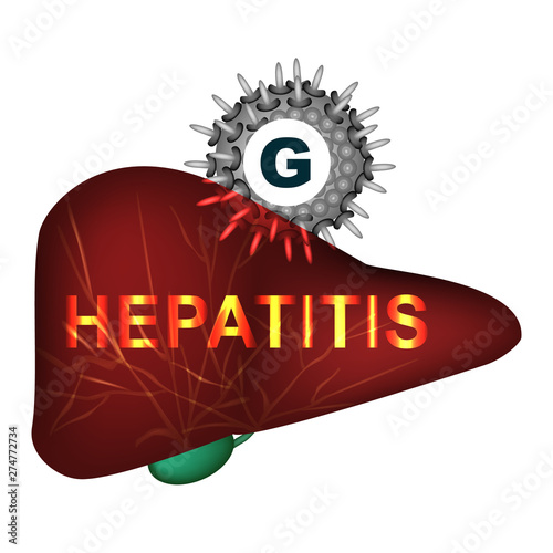 Hepatitis G. World Hepatitis Day. Infographics. Vector illustration on isolated background.