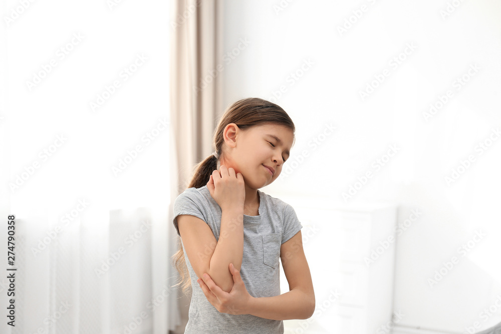 Little girl scratching neck indoors. Allergy symptoms Little girl scratching neck indoors. Allergy symptoms