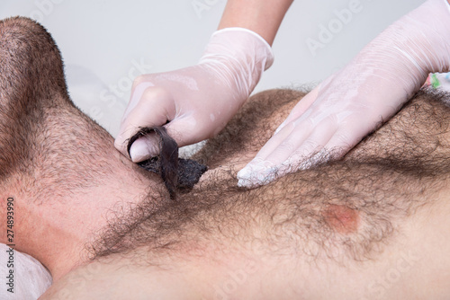 Closeup of male chest with hair and wax. Professional shugaring master in gloves makes depilation to a young man in the salon