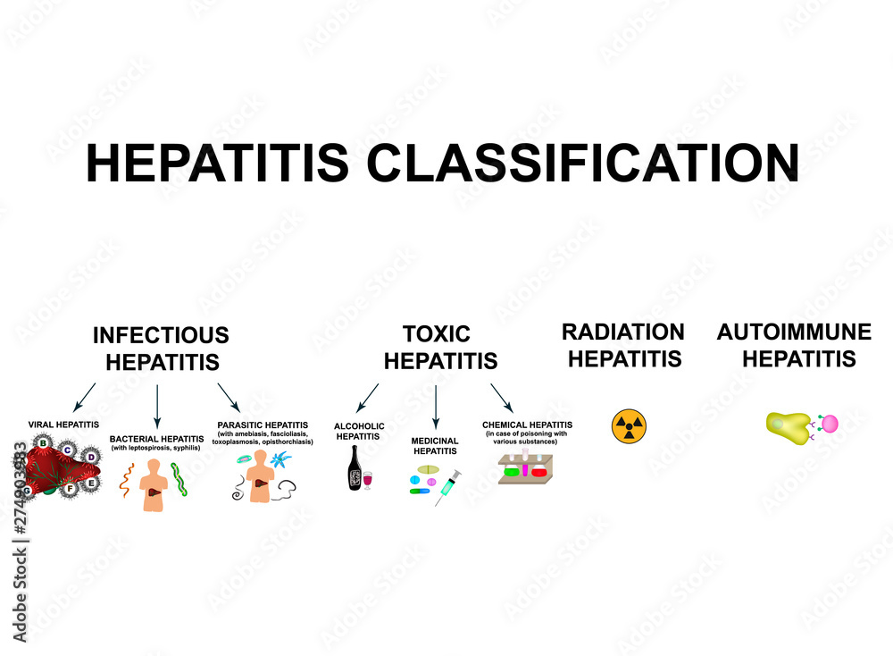 Hepatitis A Was Ist Das Vetor de Types of viral hepatitis. Classification of Hepatitis A, B, C