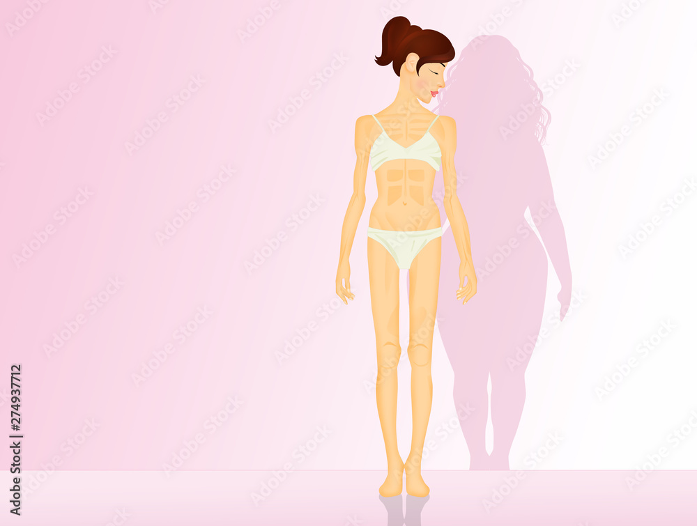 illustration of anorexia and bulimia illustration of anorexia and bulimia