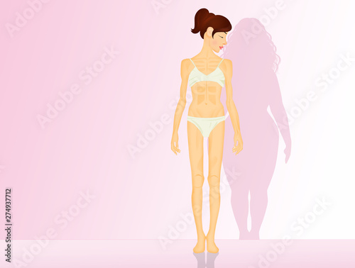Fotografía illustration of anorexia and bulimia