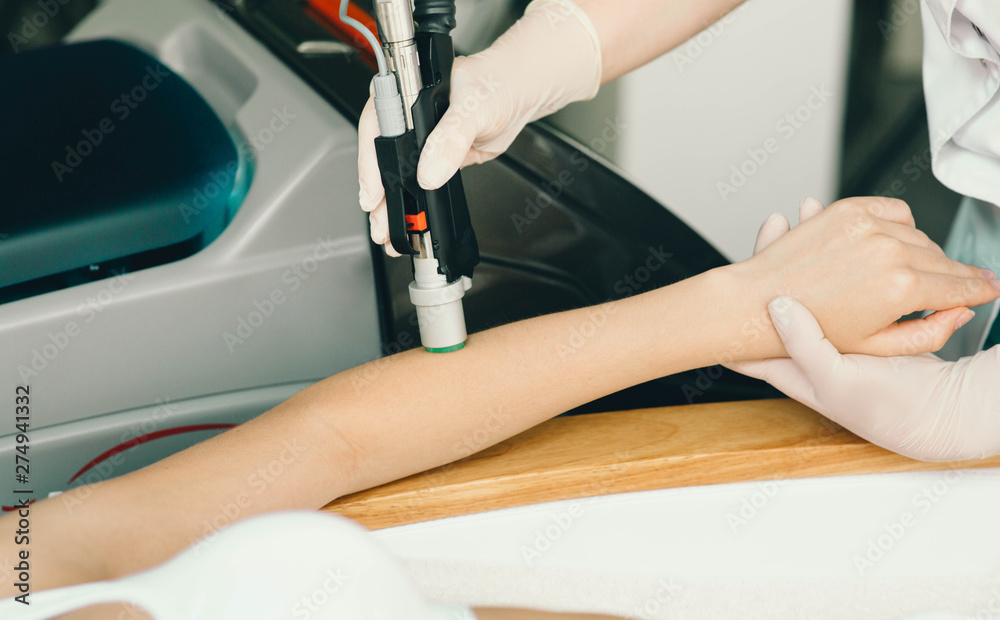 Fototapeta premium beautician removes hair on beautiful female hands using a laser. hair removal on the hands, laser procedure at clinic