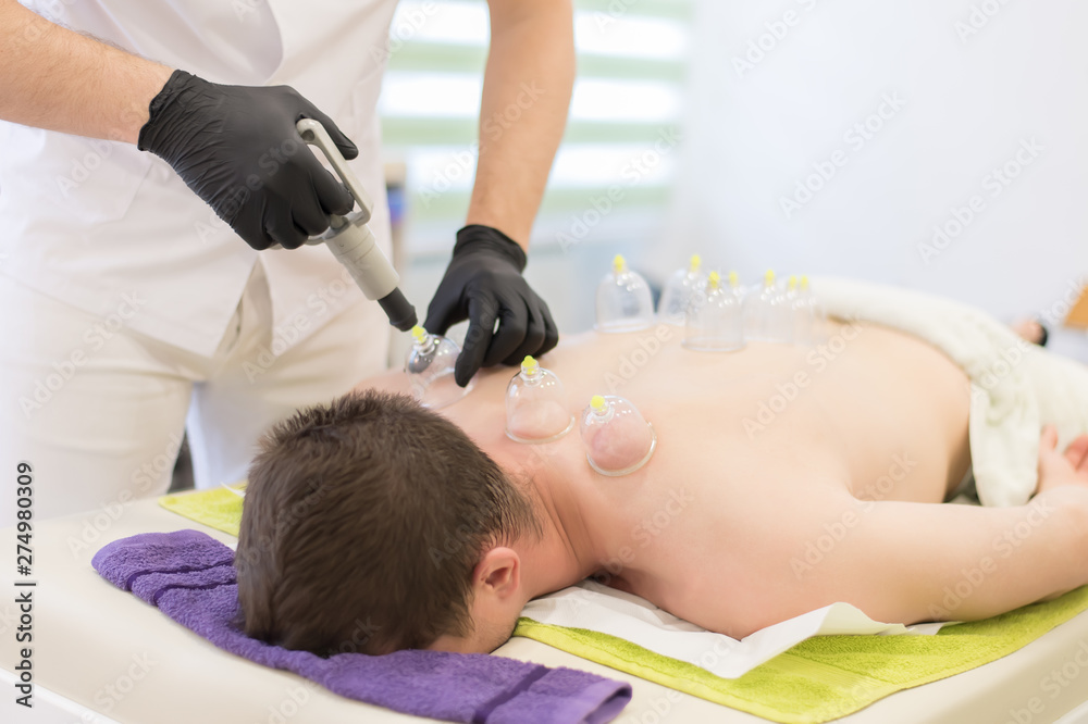 Young man laying down at the massage table and prepared for the hijama treatment