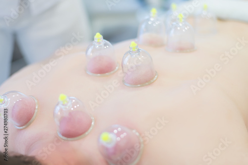 Close up of young man laying down at the massage table and prepared for the hijama treatment