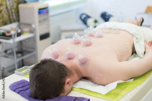 Young man laying down at the massage table and prepared for the hijama treatment photo