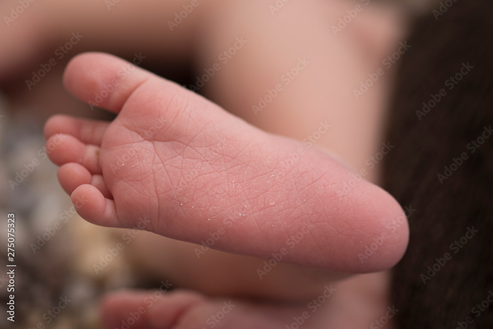 Baby feet in newborn photography Baby feet in newborn photography