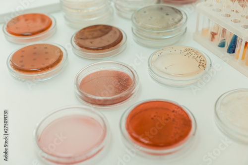 Top view of different petri dishes with samples