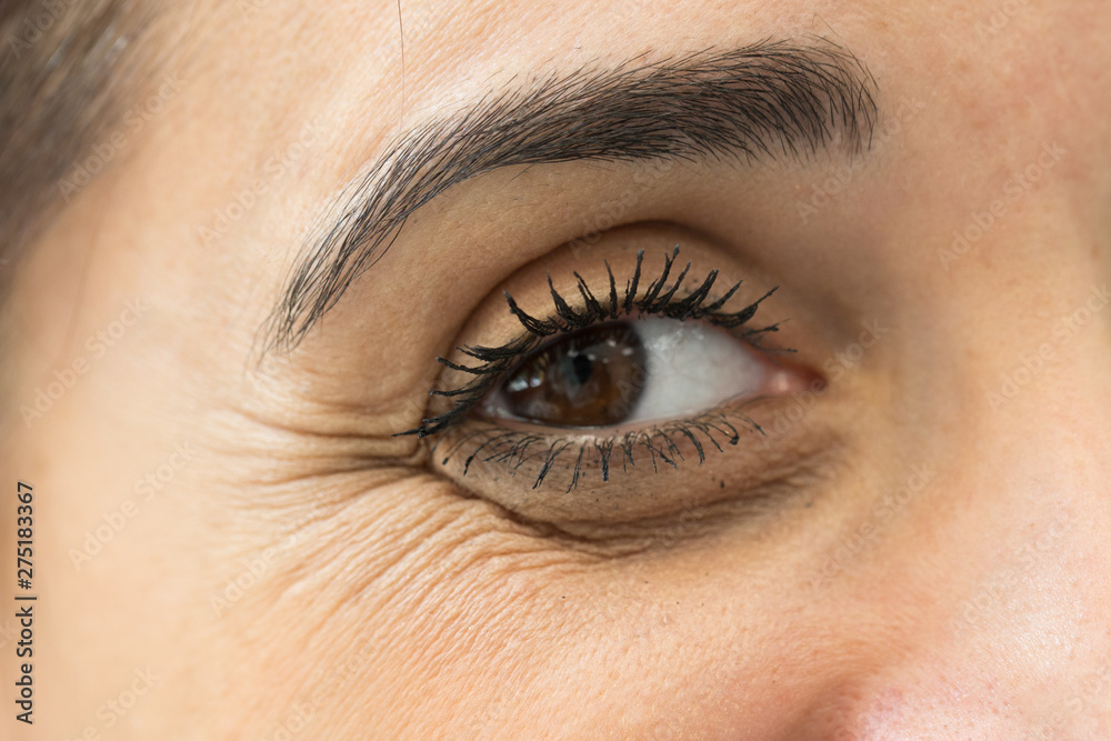 A beautiful young woman is seen up close with crow’s feet by her eye. Wrinkled face caused by aging. A common place for fillers and plastic surgery. A beautiful young woman is seen up close with crow’s feet by her eye. Wrinkled face caused by aging. A common place for fillers and plastic surgery.