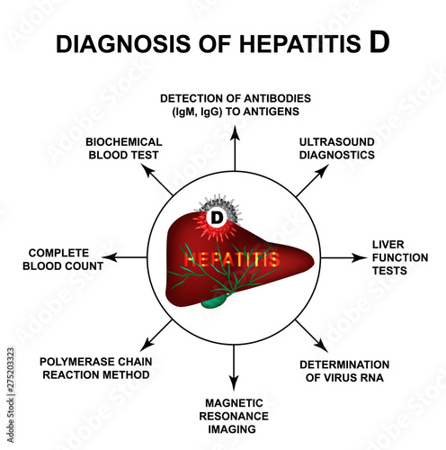 Diagnosis of hepatitis D. World Hepatitis Day. Infographics. Vector illustration on isolated background.