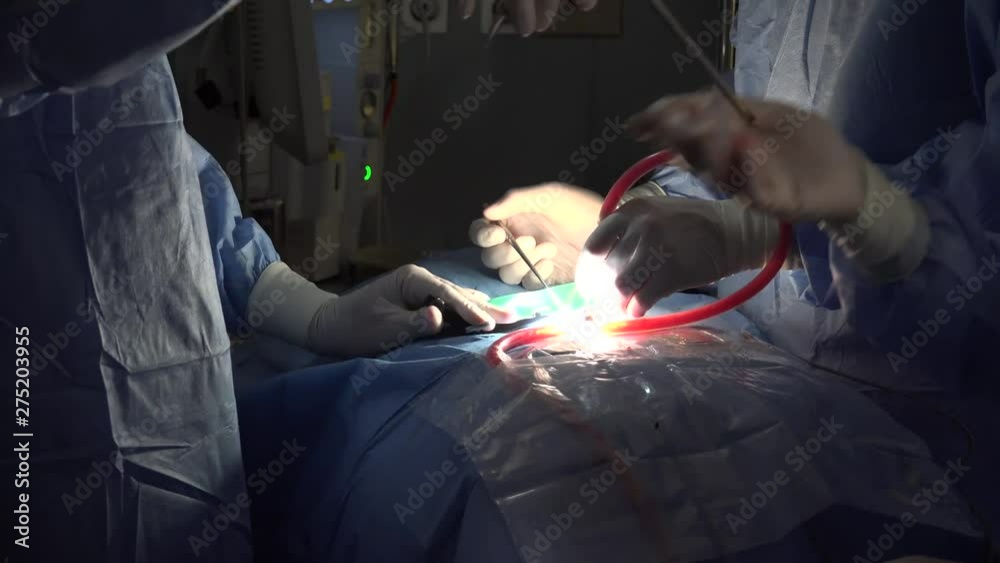 Spinal disc herniation is an injury to the cushioning and connective