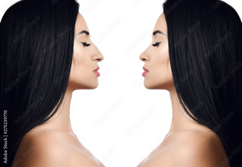 Comparison of female nose before and after plastic surgery isolated on white Comparison of female nose before and after plastic surgery isolated on white