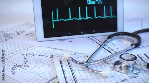 Medcal concept. Stethoscope and cardiolodi diagnostic analise  photo