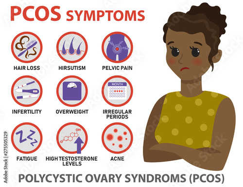 Symptoms of PCOS infographics. Detailed vector infographics.