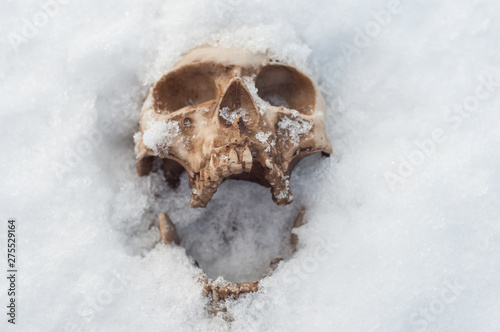  skull covered with snow and ice.  human skull. buried human remains