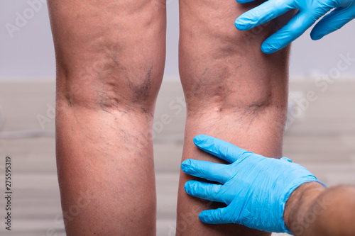 Surgeon Examining Patient's Leg