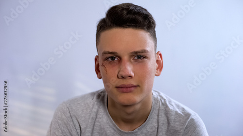 Upset male teenager with wounded face looking at camera, assault in family