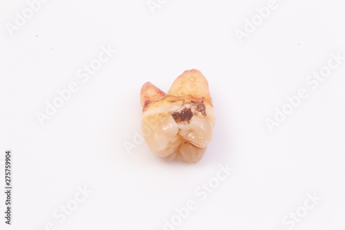 Caries on the teeth on the white background