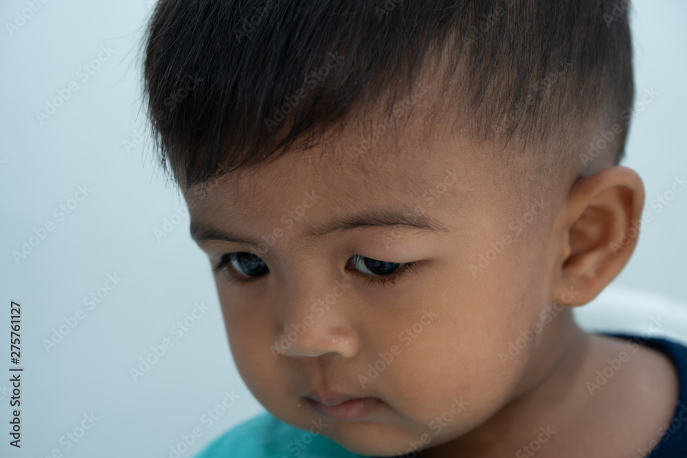 Baby has an allergic reaction to the eye, Urticaria in food allergy patien Baby has an allergic reaction to the eye, Urticaria in food allergy patien