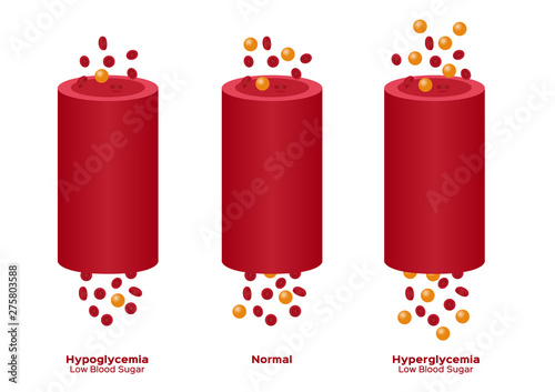 glucose in blood vector / hypoglycemia, hyperglycemia photo