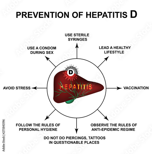 Prevention of Hepatitis D World Hepatitis Day. Infographics. Vector illustration on isolated background.