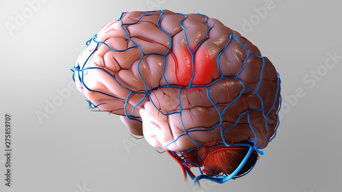 3D Brain Stroke Illustration