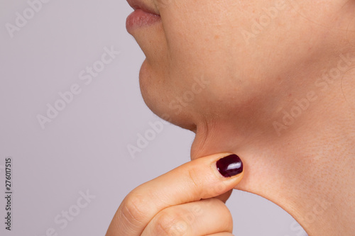 A close-up and side profile view of a thirty something Caucasian lady pinching the loose skin at the front of her throat. Commonly called a turkey neck and corrected with a platysmaplasty. photo