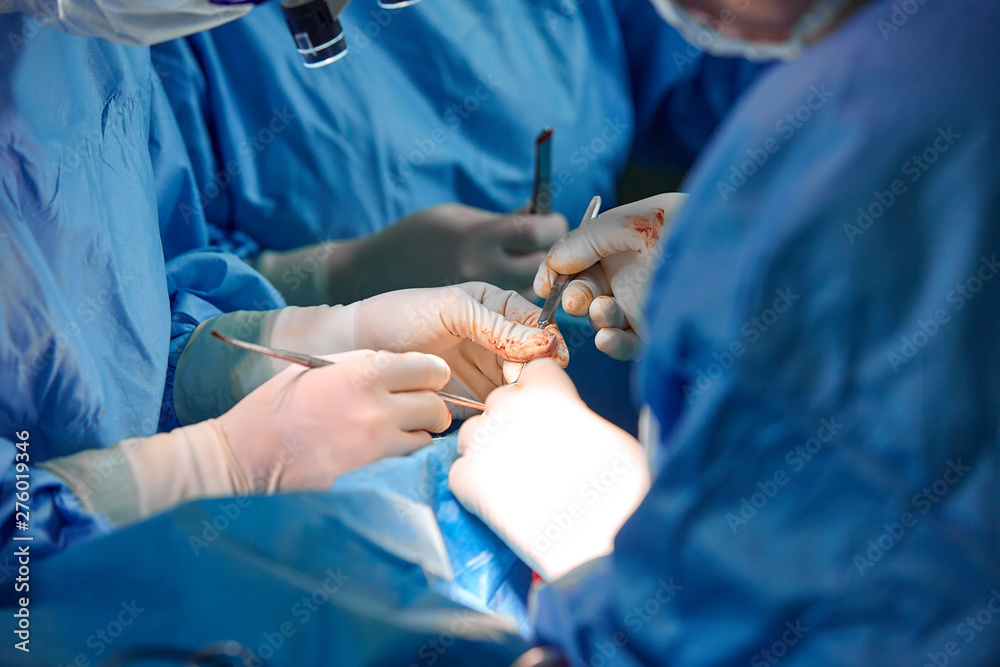 Hands hold syringes to carry fat during work. The operation to transfer fat from one part of the body to another. Platsichiskaya surgery, beauty, change of appearance. Hands hold syringes to carry fat during work. The operation to transfer fat from one part of the body to another. Platsichiskaya surgery, beauty, change of appearance.