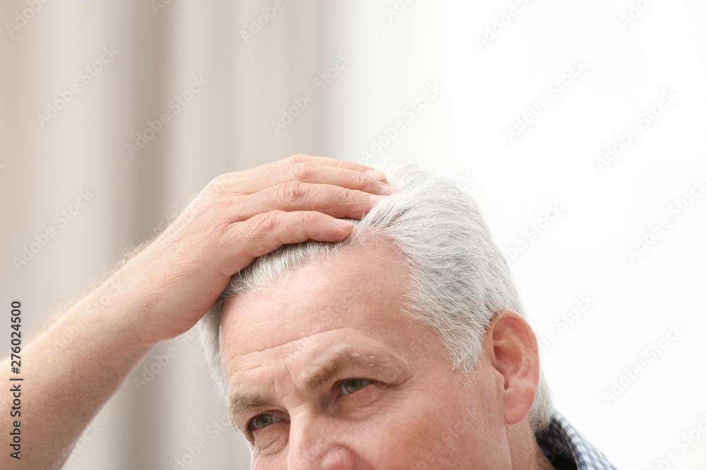 Obraz premium Senior man with hair loss problem indoors, closeup